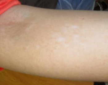 武汉医院治白环亚定行 武汉环亚中医